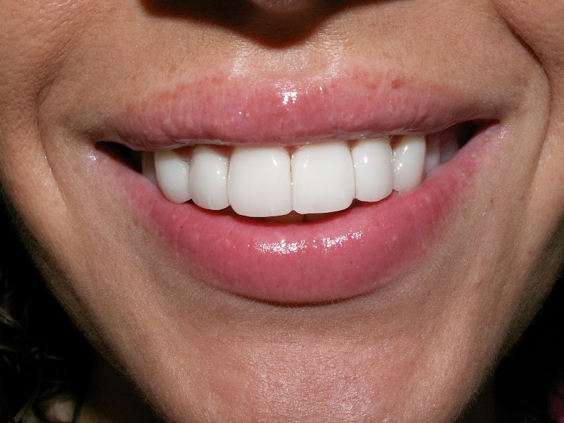 The London Centre for Cosmetic Dentistry