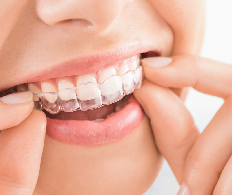 CitySmile Dental Practice - Hackney