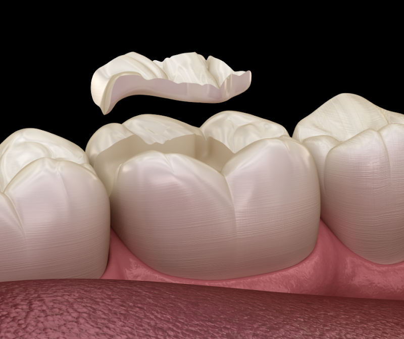 CitySmile Dental Practice - Hackney