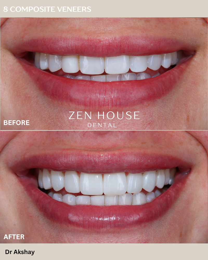 Zen House Dental Banstead