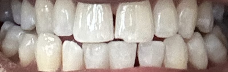 Hoe Street Dental Practice