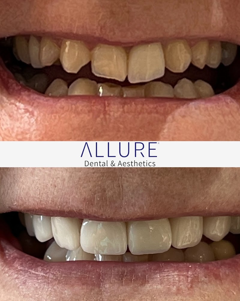 Allure Dental Care & Aesthetics