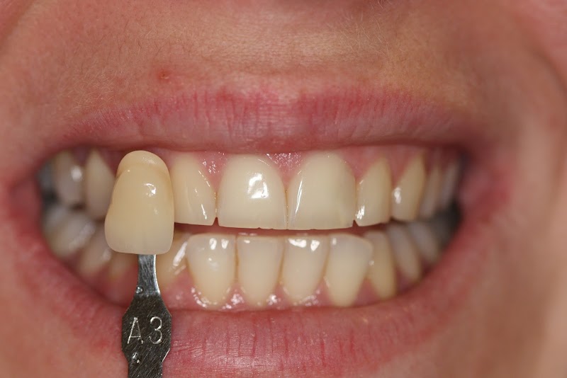 Herts Dental Implant & Sedation Clinic | Watford