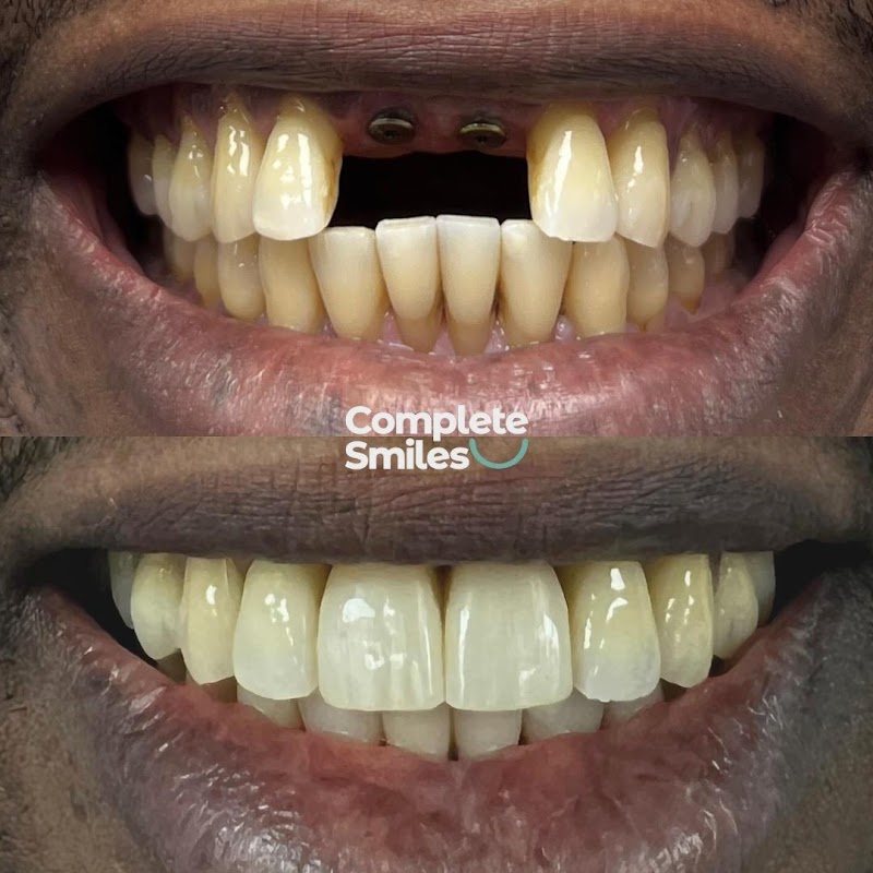 Complete Smiles Implant Centre