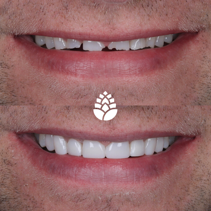 Pine Dental & Aesthetics - Belmont, Sutton