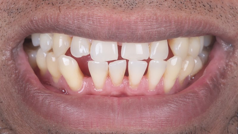 Hampstead Dental Care