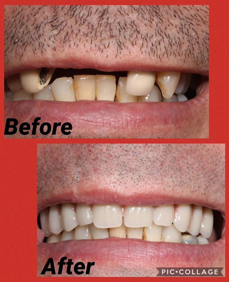 Kent Smile Studio Orpington - Composite Bonding & Private Dentist Orpington