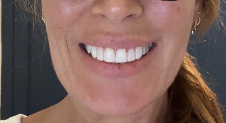 Love Teeth Dental - Chessington