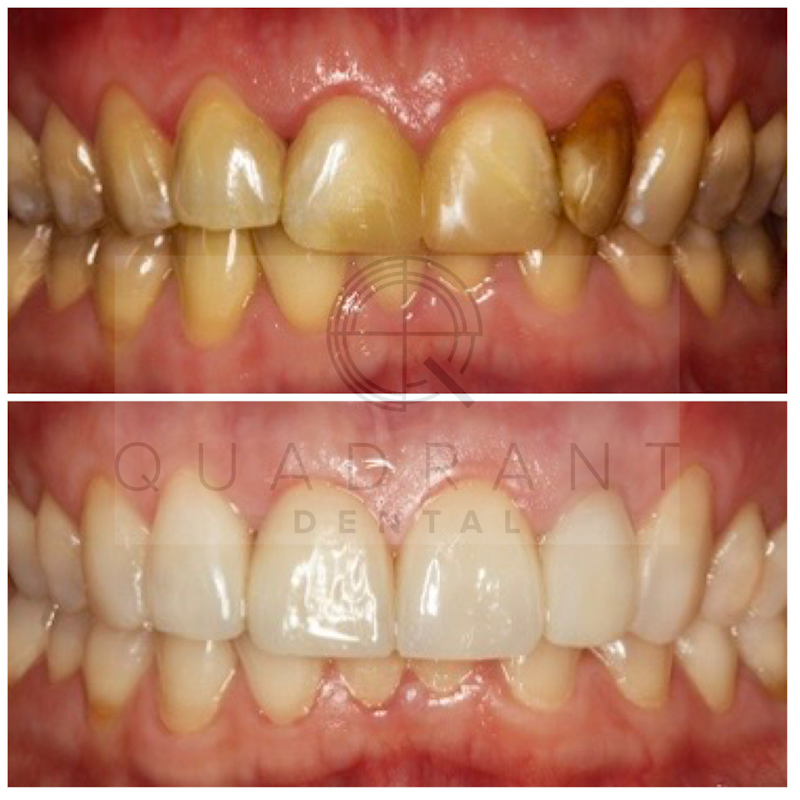 Quadrant Dental Practice