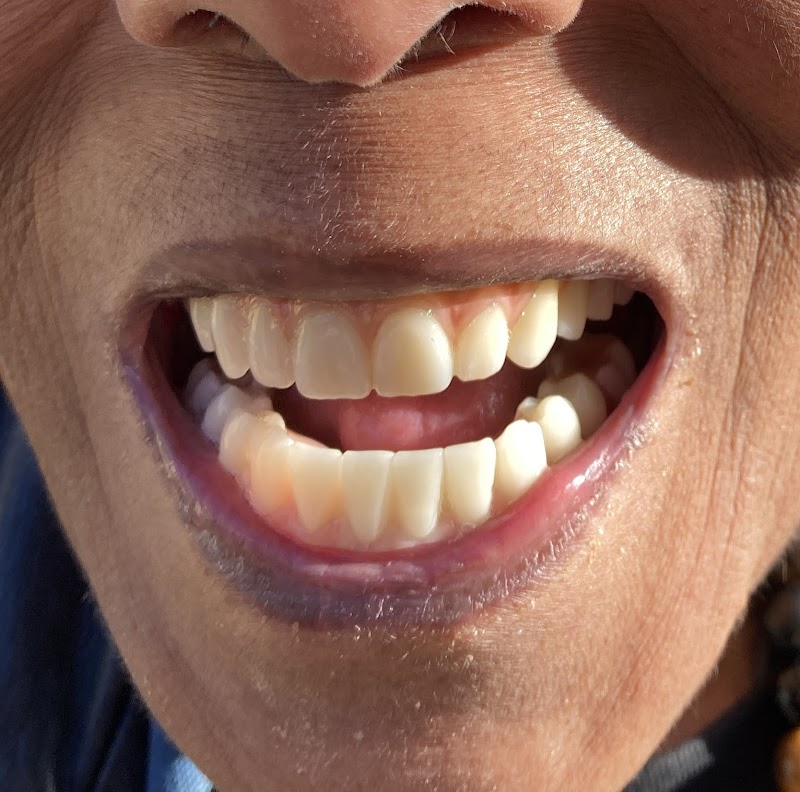 Perfect Smile - Dentist in Clapham