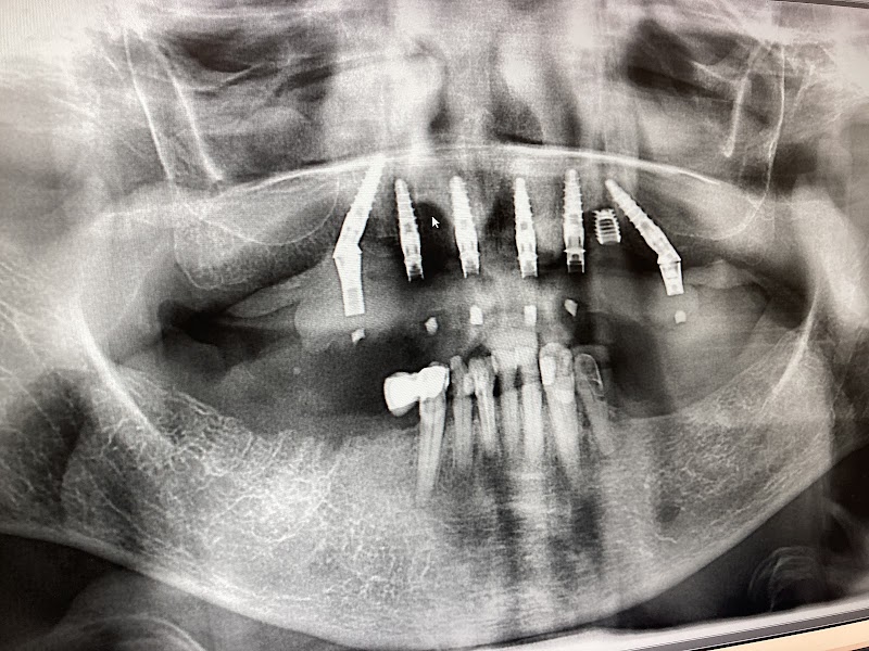 Perfect Smile - Dentist in Clapham