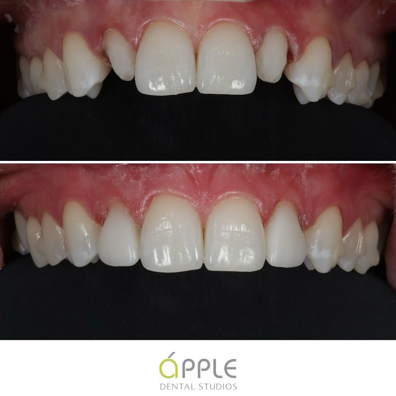 Apple Dental Studios