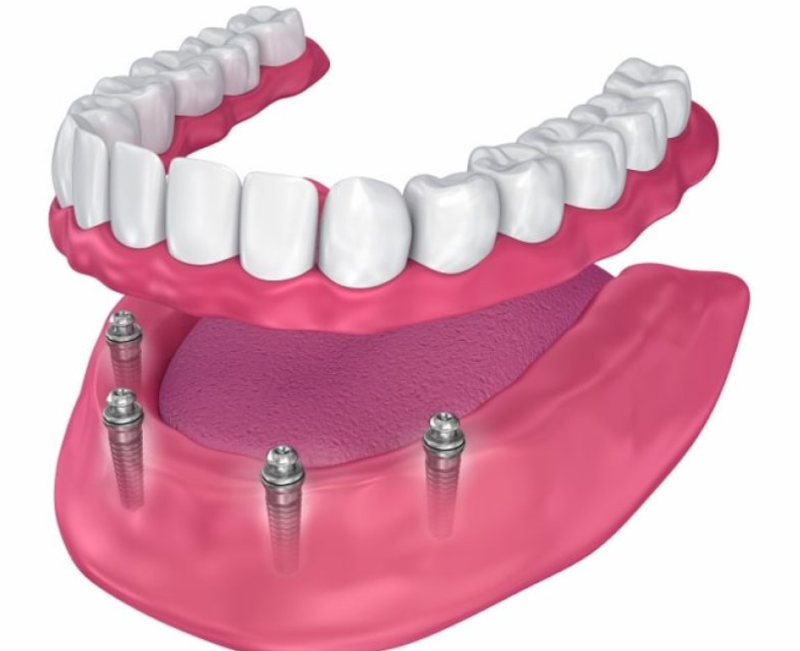 The Angel Dental Practice