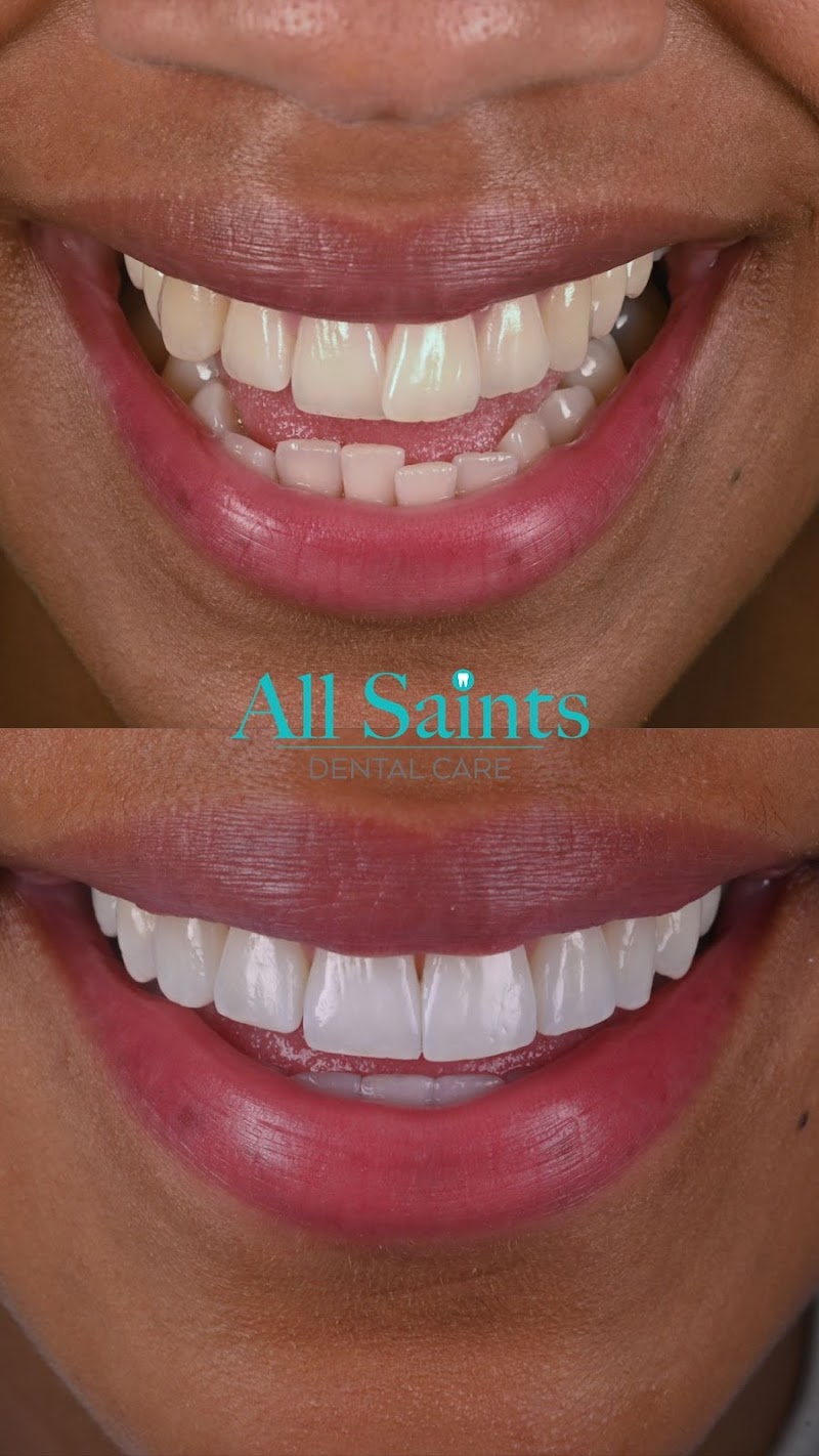 All Saints Dental Care