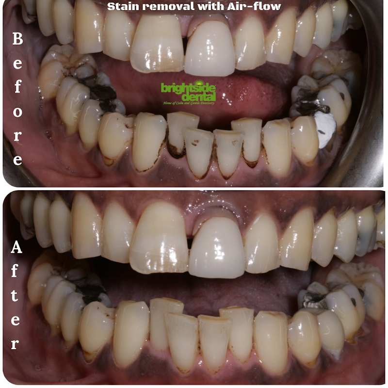 Brightside Dental - The Home Of Calm And Gentle Dentistry