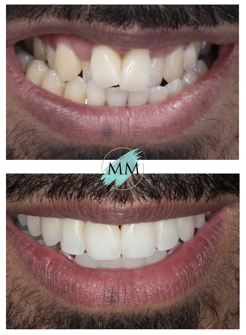 MM Dental Care Harrow - Implant Centre (formerly Ixia Dental- Implant & Sedation Centre)