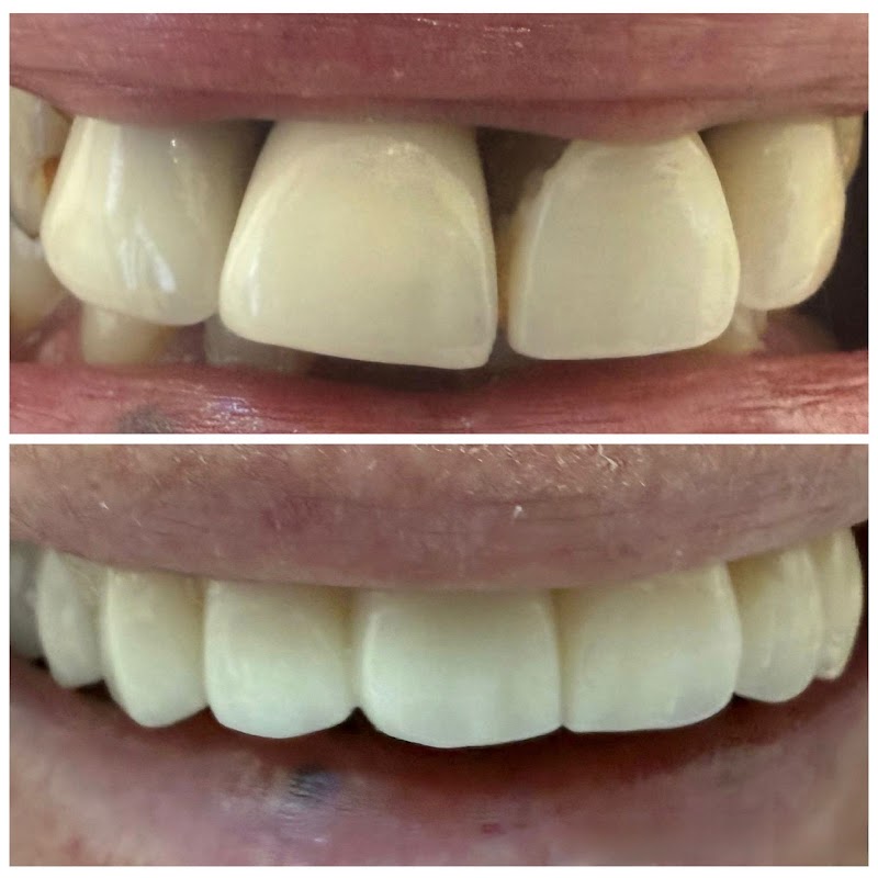 Inspire Dental Care: Implant & Invisalign Centre Rickmansworth