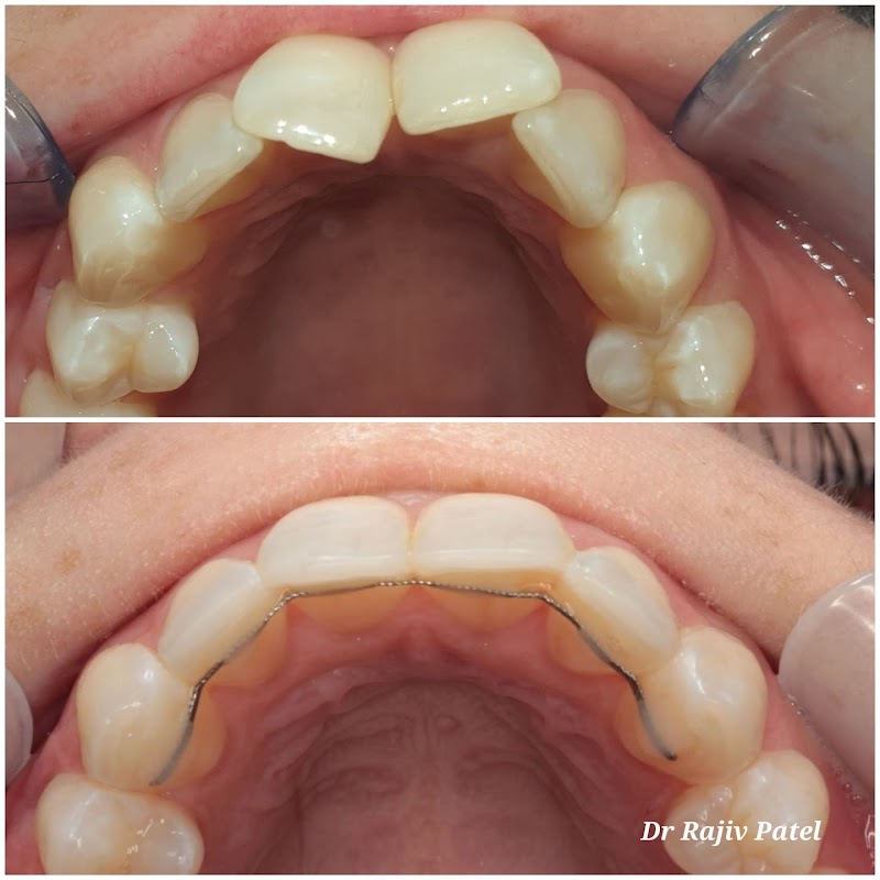 Inspire Dental Care: Implant & Invisalign Centre Rickmansworth