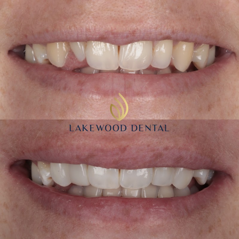 Lakewood Dental
