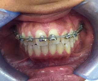 Sunny Smiles Dental & Cosmetic Innovations - Upminster Branch