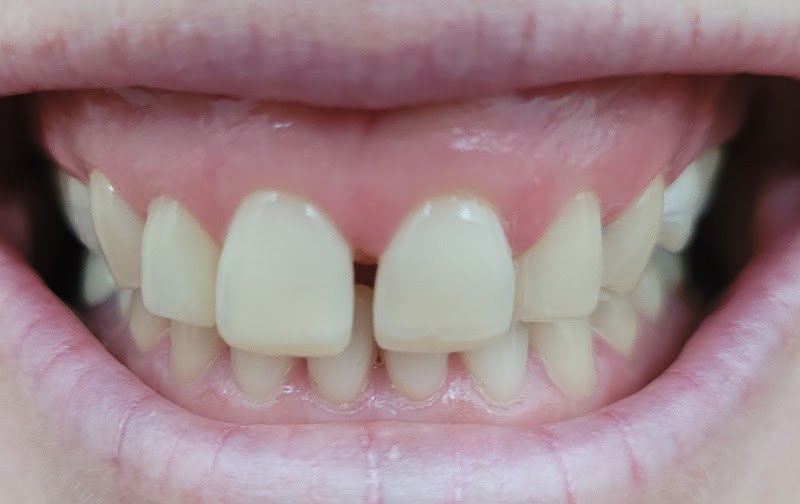 Church End Dental Clinic