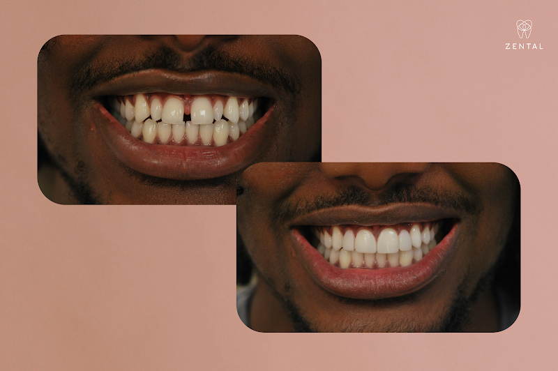 Zental Dental Bexleyheath