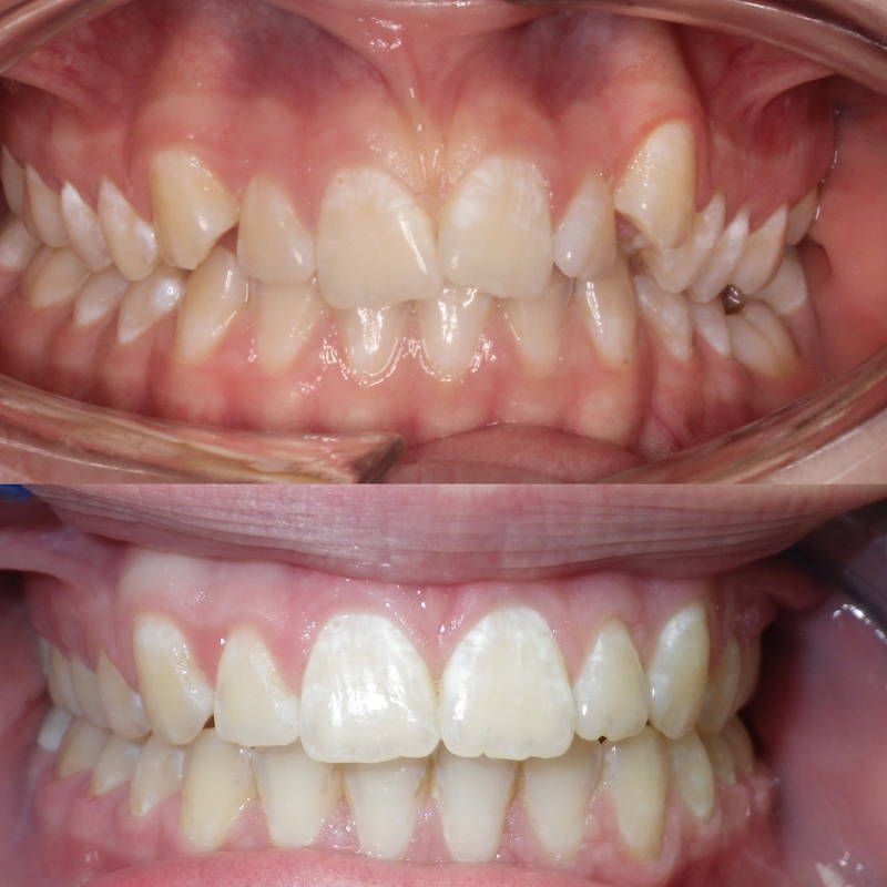 Dr Emmett Hegarty Specialist Orthodontist