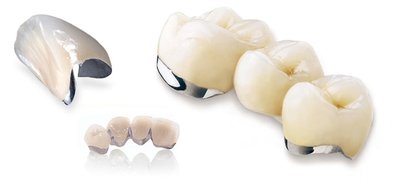 Denture Repairs London