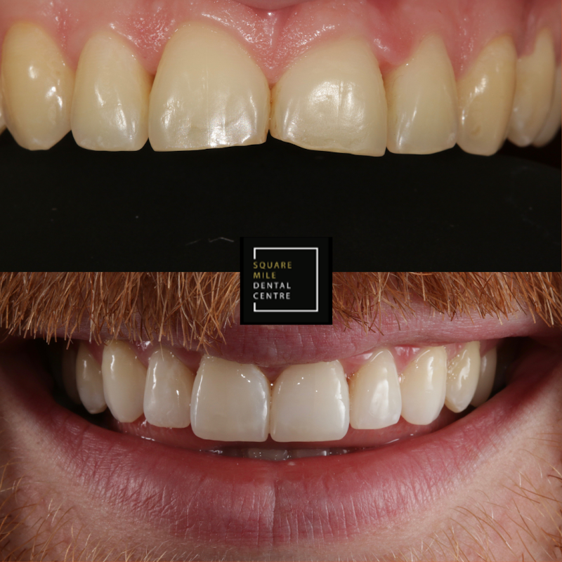 Square Mile Dental Centre