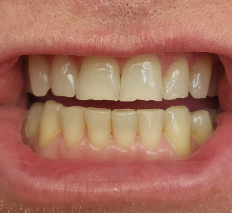 Dream Smile Dental Clinic: Lewisham & Greenwich