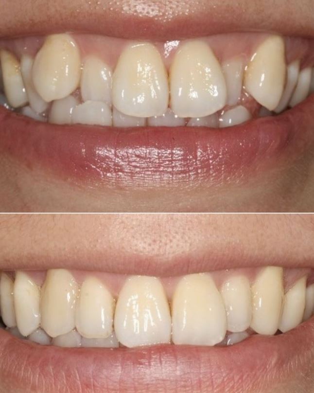 The Holland Park Dentist | Dentist in London