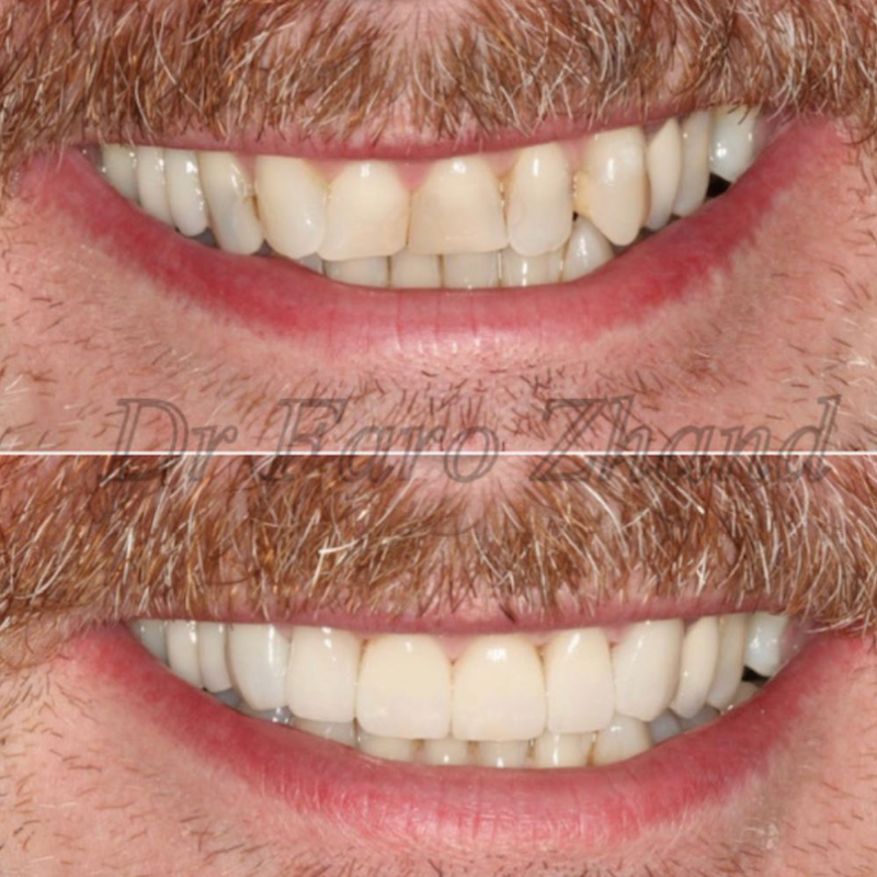 The Holland Park Dentist | Dentist in London