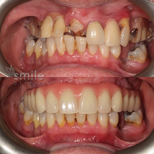 Smile Cliniq - Finchley Dentist