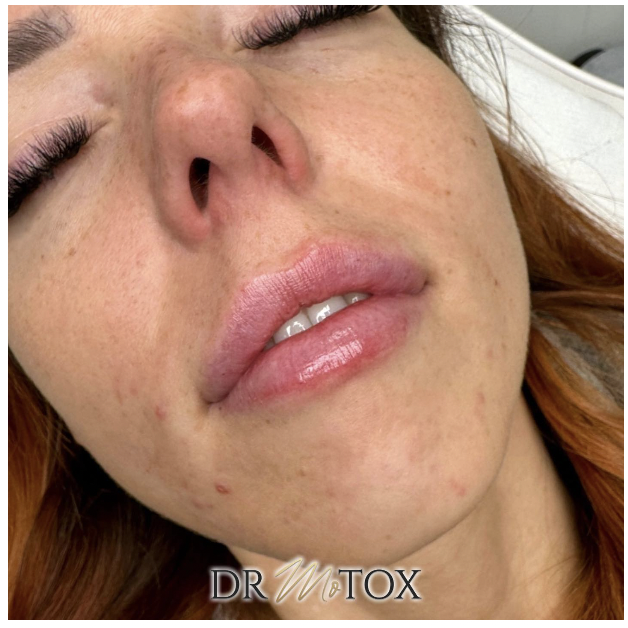 Dr Motox - Chiselhurst