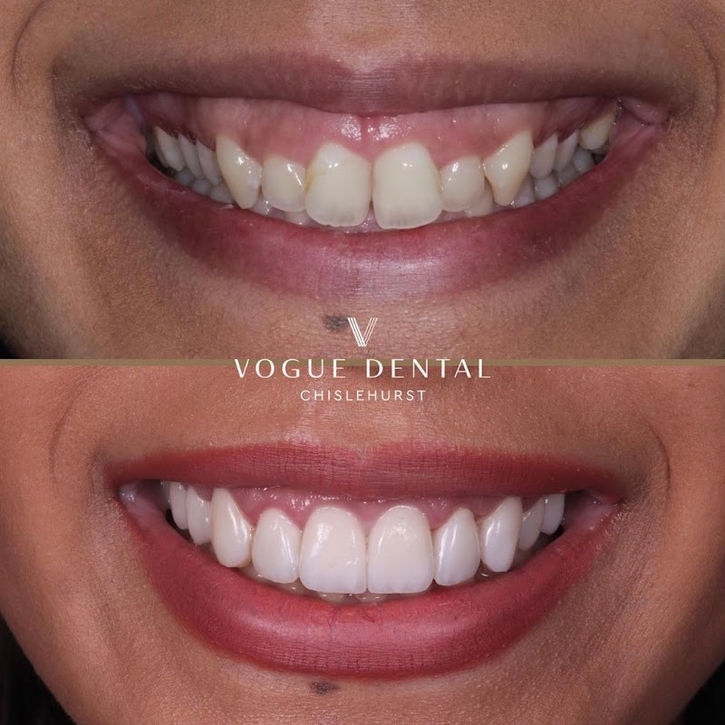 Vogue Dental