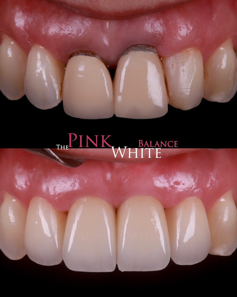 London Dental Arts Forest Hill