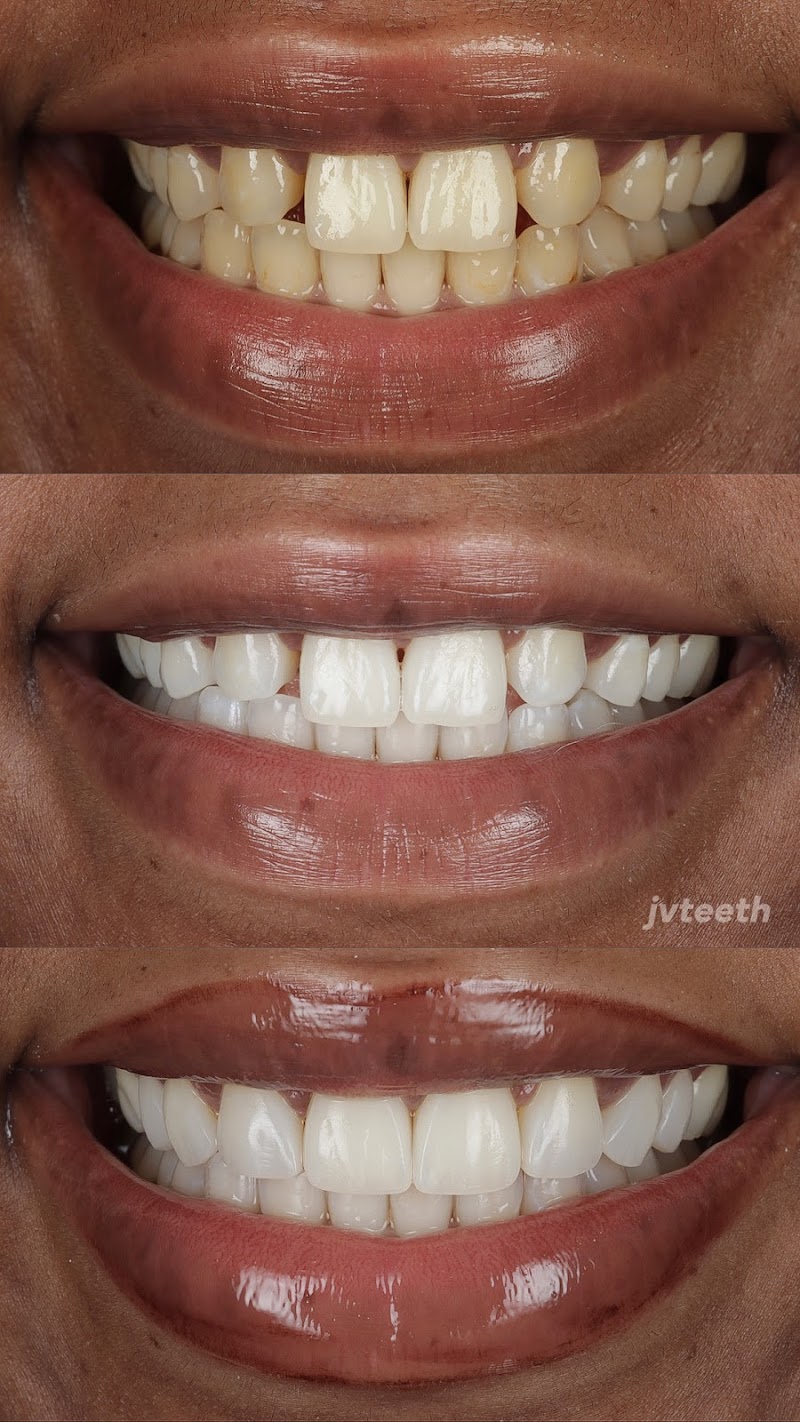 Ruh Dental - Notting Hill Gate