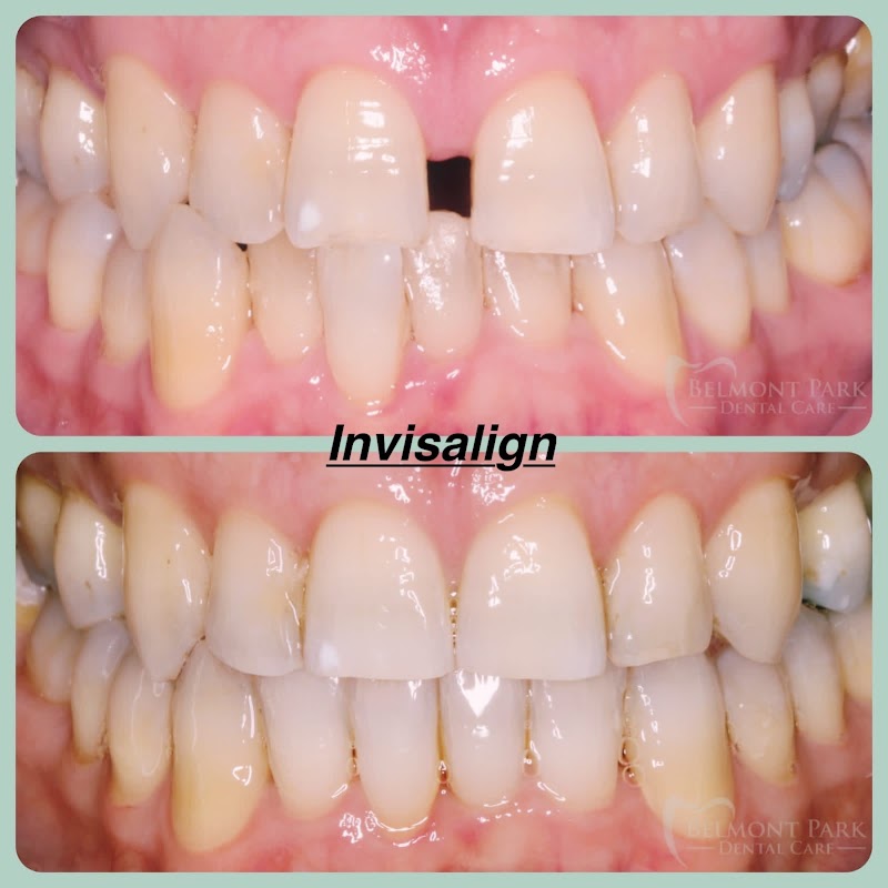 Belmont Park Dental and Implant Care