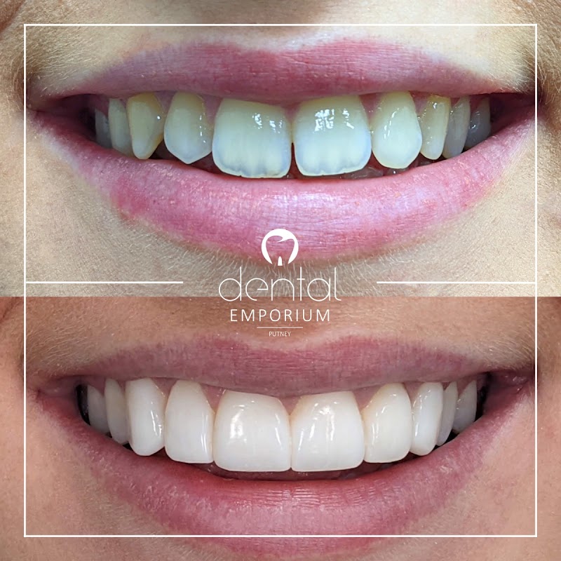 Dental Emporium Putney