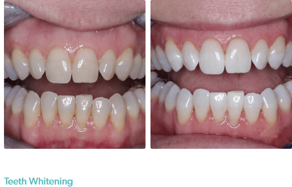 Smile Kensington Dental Care & Implant Centre