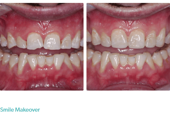 Smile Kensington Dental Care & Implant Centre