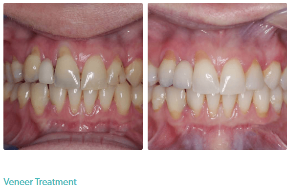 Smile Kensington Dental Care & Implant Centre