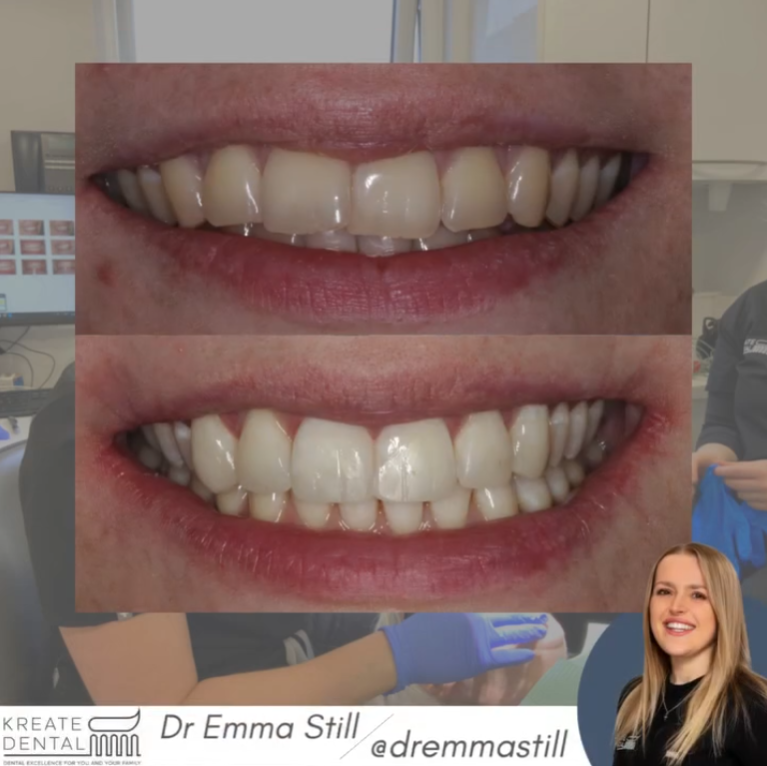 Kreate Dental Dartford | Dental Excellence For You And Your Family