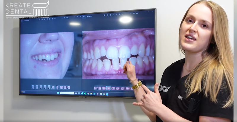 Kreate Dental Dartford | Dental Excellence For You And Your Family