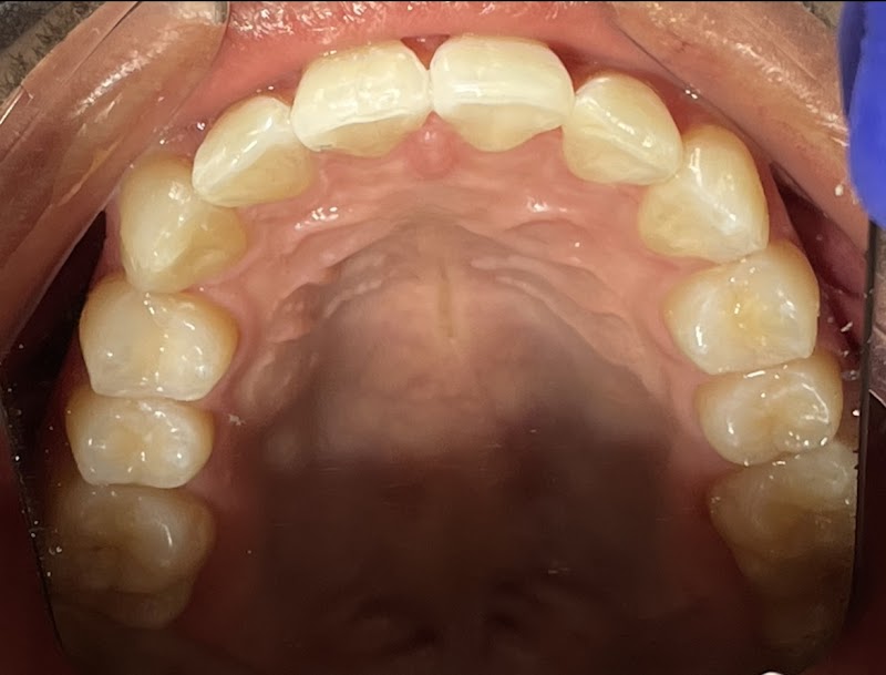 Revive Clinic Dental & Facial Aesthetics - Bayswater