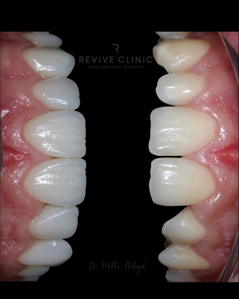 Revive Clinic Dental & Facial Aesthetics - Bayswater