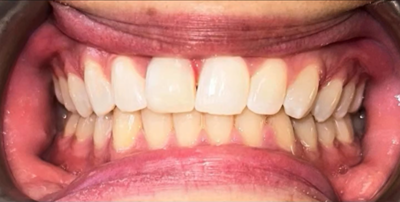 Smile Dental Practice Croydon