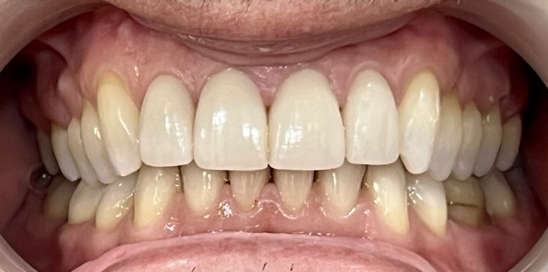 New Ash Green Dental & Aesthetics - Kent