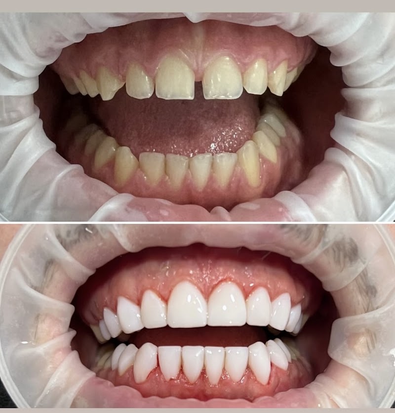 Tooth Club - Romford