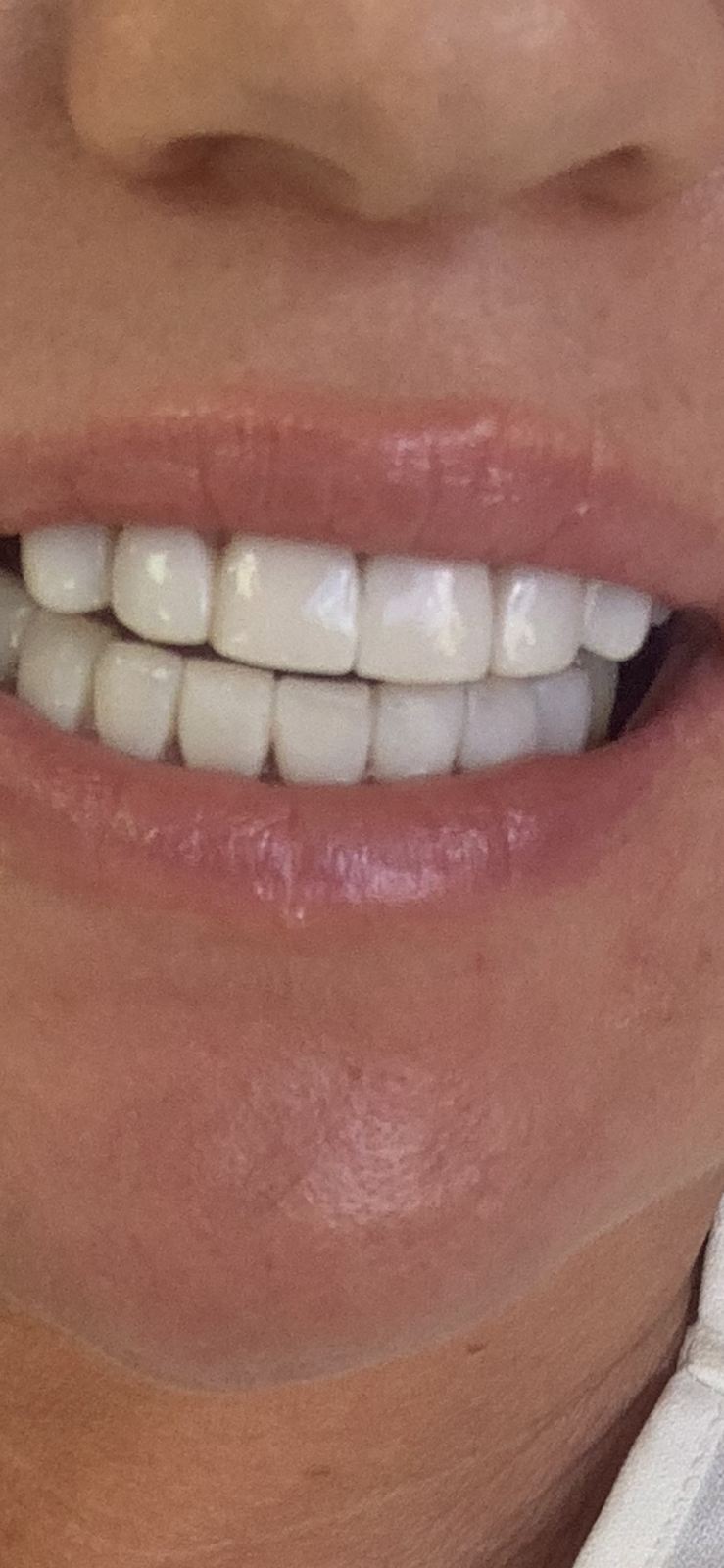 Tooth Club - Romford